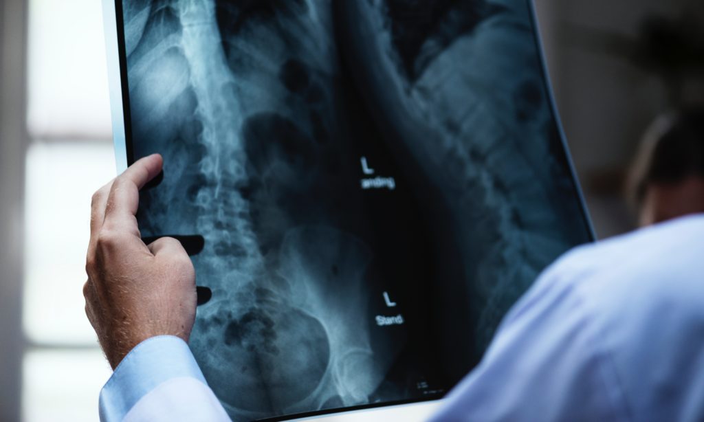 Photo of a nurse practitioner inspecting the x-ray of a patient