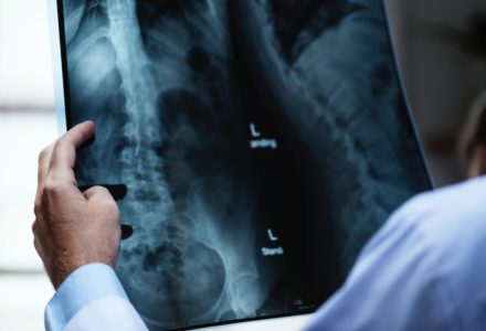 Photo of a nurse practitioner inspecting the x-ray of a patient